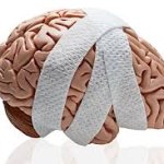 Understanding Brain Injuries and Recovery